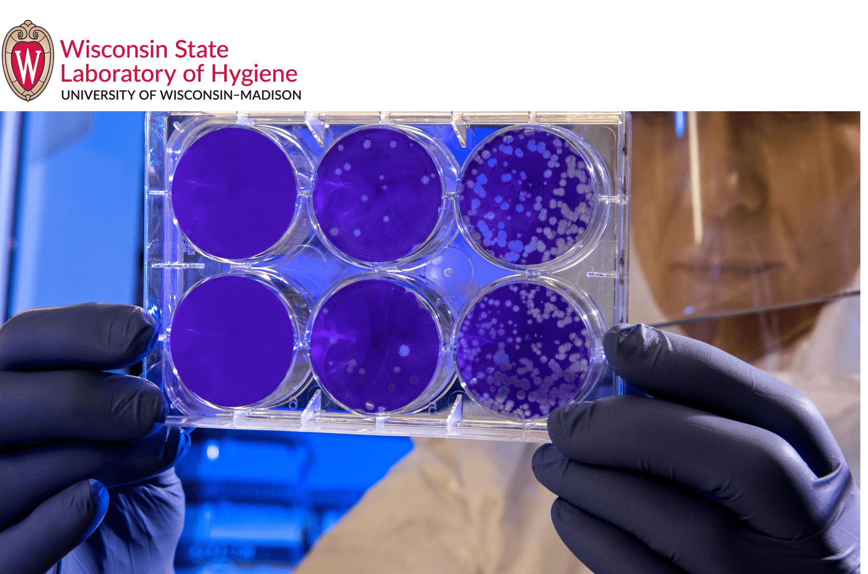 Wisconsin-Genemod-Case-Study
