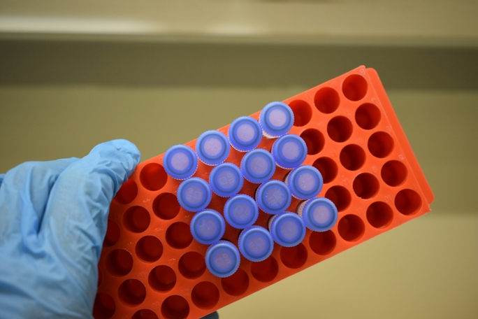 securing-biorepository-assests-with-advanced-lab-data-management-software